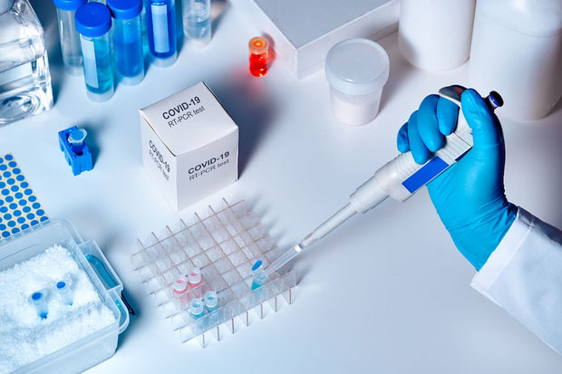 koronavirusa-yoluxanlarin-sayi-17-milyonu-kecdi-statistika